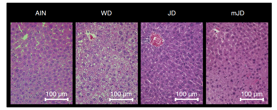 日本饮食组与西方饮食组肝脏细胞脂质积累对比图