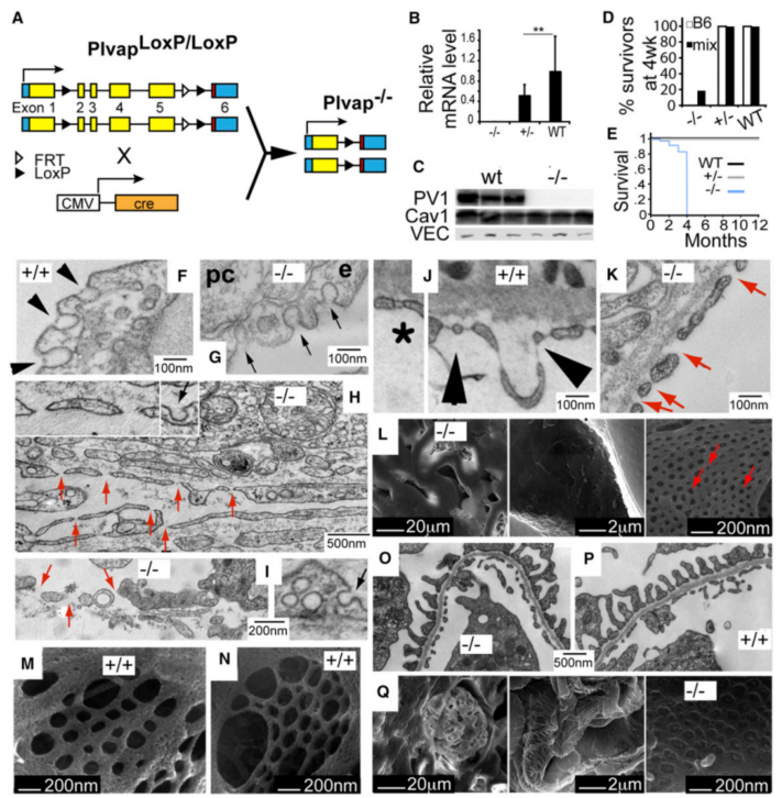 图1A:PV1蛋白基因敲除小鼠模型构建流程示意图 展示LoxP位点插入位置;图1B:PV1基因敲除小鼠不同组织mRNA表达水平柱状图对比图1C:Western blot检测PV1蛋白在不同器官中的表达变化;图1D:不同基因型小鼠生存率对比曲线图 显示混合基因型生存优势;图1E:PV1基因敲除小鼠与正常小鼠体型对比实拍图 显示生长迟缓特征